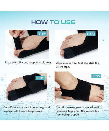 Bunion Corrector Orthopedic Big Toe Separator for Men & Women - Bunion Relief & Straightening Splint for Hallux Valgus Foot Care - Buy Online on GoSupps.com
