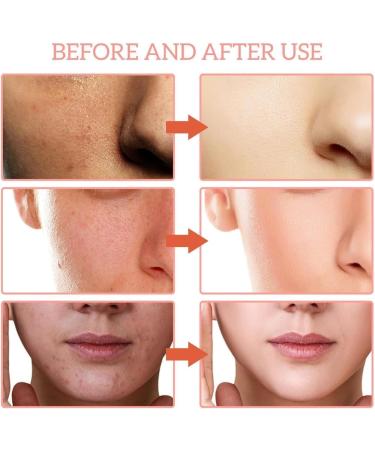 FLLUOUZH 3 PCS Skin Vitamin Serum 5 in 1 Anti Wrinkle Firming Serums Full Face and Body Wrinkle Lifting and Firming Essence Nourishing and Hydrating Reduce Fine Lines Hyaluronic Acid - Buy Online on GoSupps.com