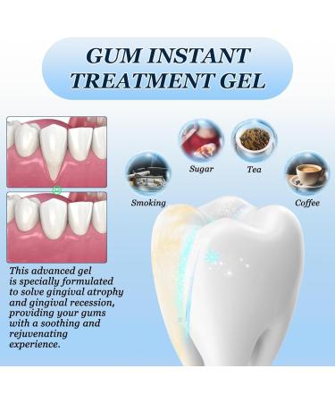(100% 5 star) 4PCS Gum Shield Therapy Gel Dentizen Gum Therapy Gel | Gum Shield Therapy Gel and Whitening | Teeth Whitening Essence Pen | Gum Instant Treatment Gel | Gum Therapy Gel - 4ml/0.14fl.oz - Buy Online on GoSupps.com