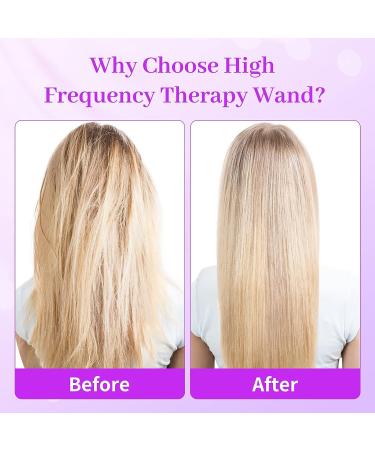 High Frequency Facial Wand Set - 4 Piece Machine for Face, Eyes, Hair, Body - Buy Online on GoSupps.com