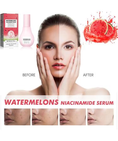 Watermelon Serum Watermelon Glow Niacinamide Moisturize Serum Niacinamide Serum Lightweight Hydrating Brightening Facial Serum Skin Lifting Anti-aging & Wrinkle Remove Face Serum for Women - Buy Online on GoSupps.com
