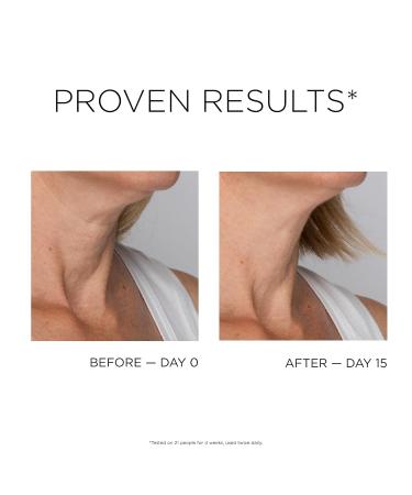 IDC Dermo Profil D collet Cream - Vegan Anti-Aging Firming & Lifting Cream for Neck & D collet - 2.7 fl oz Breast Lift Peptide Complex - Buy Online on GoSupps.com