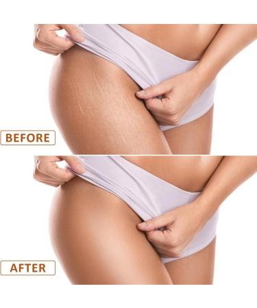 Funmo Glow Remedy Oil 2 pieces with 99 natural ingredients skinfixing body oil luxury body oil body oil moisture and improved skin elasticity 200 ml - Buy Online on GoSupps.com