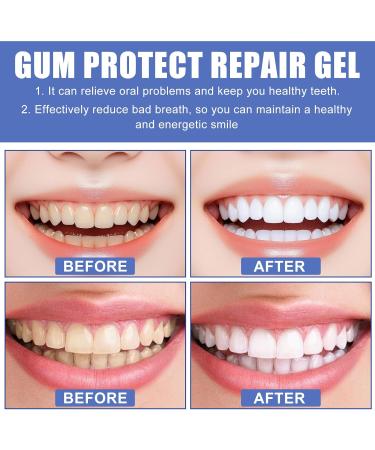 3PCS Gum Protect Dental Gel Professional Gum Health Solution - Buy Online on GoSupps.com