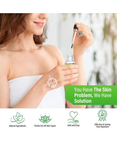 Memonotry Skin-Tag-Remover-Serum 30.00ml - Extra Strength Treatment for Skin Tags & Warts - Painless & Safe Removal - Pack of 1 - Buy Online on GoSupps.com