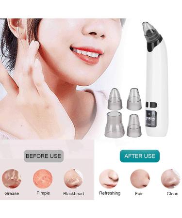 Electric Blackhead Remover & Pore Cleaner Set - Hot Compress Skin Care Tool for Women | Best Spot Sucker for Clear Skin - Buy Online on GoSupps.com