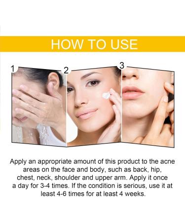 KOAHDE Facial Anti Acne Essence Acne Essence Anti Acne Hydrating Essence Anti Acne Facial Serum Acne Treatment Serum Serum Skin Smoother Acne Removing Moisturizing Serum Skin Rejuvenation Serum - Buy Online on GoSupps.com