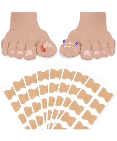 Ingrown Toenail Treatment - Painless Corrector Strips & Nail Correction Patches | 100 Pcs - Buy Online on GoSupps.com