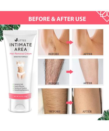Flawless Hair Removal Cream for Women - Sensitive Formula for Underarms & Intimate Areas - Buy Online on GoSupps.com