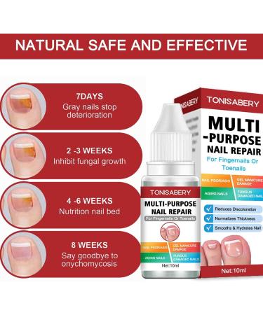 EUBEISAQI Multifunctional nail repair Nail renewal Nighttime Nail 10ml Fungi Fingernail & Toe Nail Solution for broken cracked and discolored nails or fingernails - Buy Online on GoSupps.com