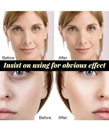  Stronrive 3 Facial Lifting Protein - Absorbable collagen protein thread for facial filling | Improves skin elasticity stretches the skinline - Buy Online on GoSupps.com