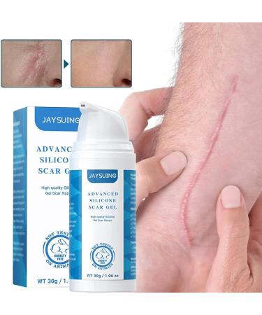 Gomice Scar | Scar Repair Gel for Stretch Marks | Scar Treatment for Surgical Scars Caesarean Sections Cuts & Burns Reduce - Buy Online on GoSupps.com