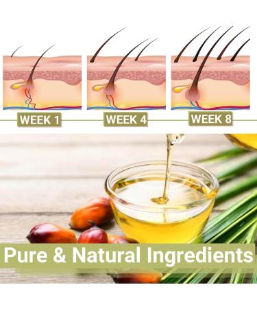 Huile de croissance des cheveux Lifewitqueenp Queenp Ayurvedic Hair Growth Huile l ger pour tous les types de cheveux 1Pcs - Buy Online on GoSupps.com