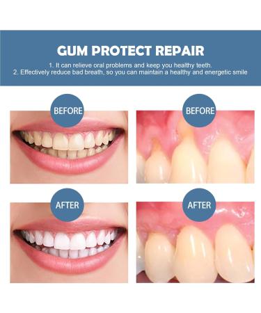 Kohde Gums Offspring Gel - Natural Gum Repair & Therapy Gel for Alleviating Gum Loss | 3ml | 3PCs | Optimal Gum Care - Buy Online on GoSupps.com