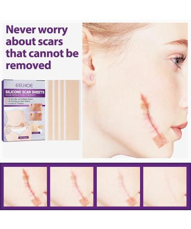 Actsyl-3 Silicone Scar Removal Sheets - Professional Grade for Surgery, Burns, Keloids & Stretch Marks - Reusable for Old & New Scars - 4 Sheets for Glowing Skin Care - One Size - Buy Online on GoSupps.com
