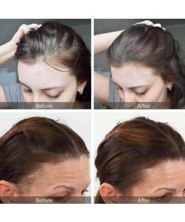 VOLLUCK Root Touch up Powder Long-lasting Hairline Powder for Men Women Waterproof Root Cover up for Hairline Bald Spots 8g (Black) - Buy Online on GoSupps.com