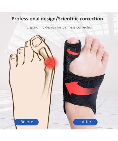 Entatial Bunion Corrector - 1pc Transpiration Hallux Valgus Corrector | Black SBR Foot Support for Comfort & Correction - Buy Online on GoSupps.com