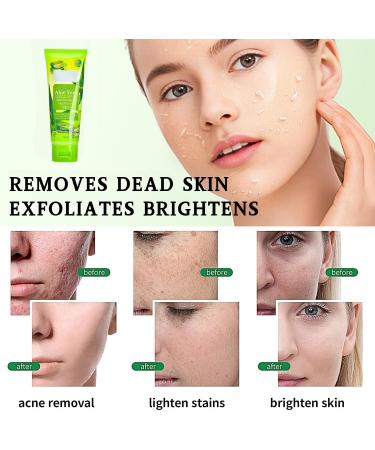 Aloe Vera Facial Scrub Aloe Vera Body Exfoliator Natural Exfoliating Face Scrub Aloe Vera Gel For Face Scrub Exfoliator Clean Pore Dirt Oil Control-Moisturizing Hydrating Smooth Tender Refreshing - Buy Online on GoSupps.com