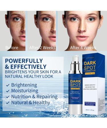 Le'phoqua Dark Spot Remover Cream 1.7 Fl Oz - SPF 30 for Face & Body | Fade Blemish & Hyperpigmentation | All Skin Types - Buy Online on GoSupps.com