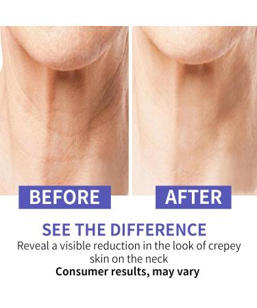 Neck Firming Cream - Advanced Anti-Aging Cream for Tightening Wrinkle Reduction & Even Skin Tone | Repair Complex for Decolletage & Double Chin - Buy Online on GoSupps.com