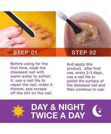 Pureskin Fungal Nail Renewal - Maximum Strength Treatment for Nail Fungus, Athlete's Foot, Ringworm - 1.0 Ounces - Buy Online on GoSupps.com