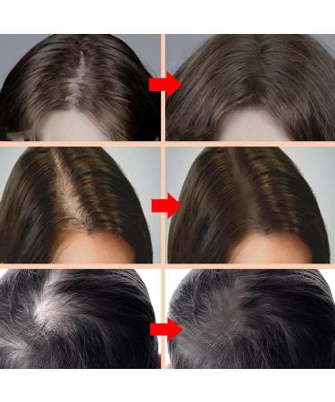 Waterproof and Sweat Resistant Multipurpose Hairline Contour Powder Hair Line Powder Hair Ombre Hairline Powder 8g (Light Brown) - Buy Online on GoSupps.com