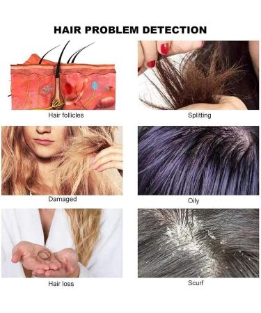 Scalp Detector 11 Inch Hair Follicle Facial Skin Oil Moisture HD LCD Screen Microscope Tester 200X/50X Dual Lens Skin Health Detection Machine - Buy Online on GoSupps.com