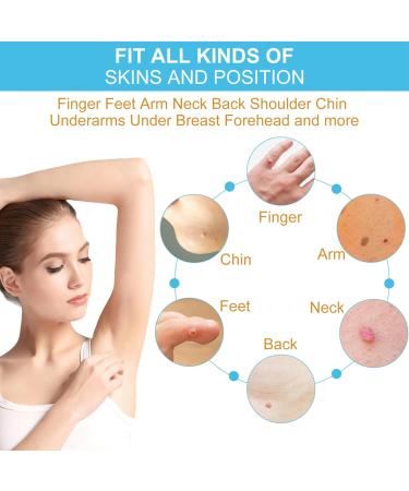 Skin Tag and Mole Removal Lotion - Fast-Acting Natural Remover for Warts - Easy Home Treatment (2PCS 40ML) - Buy Online on GoSupps.com