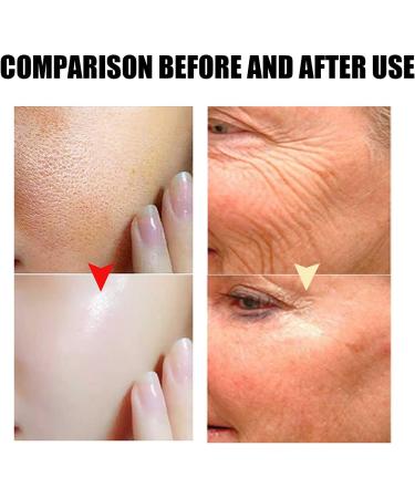 Turmeric Vitamin C Clay Mask- Face Masks- Deep Cleansing Unclog Pores- Dark Spot Remover -Controlling Acne Oil- Reduce Redness and wrinkles- Face Mask Beauty & Skincare 50g - Buy Online on GoSupps.com