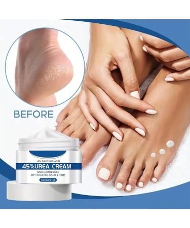  bellv Moisturizing foot cream - Anti-crack cream for heels and hands - Fast-acting lotion - Travel-friendly moisturizing gel for home dorm business trips travel etc. - Buy Online on GoSupps.com