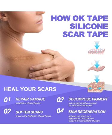 OK TAPE Silicone Scar Tape Roll - Professional Scar Removal Sheets for Surgical Scars - Reusable Silicone Strips for Keloid, C-Section, Tummy Tuck - 1.6 x70 Roll - Buy Online on GoSupps.com