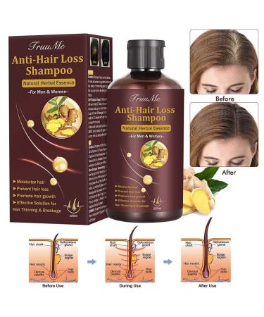 Hair Growth Shampoo, Hair Loss Shampoo, Hair Thickening Shampoo, Helps Stop Hair Loss, Grow Hair Fast, Hair Loss Treatment for Men & Women (220mL) 7.44 Fl Oz (Pack of 1)
