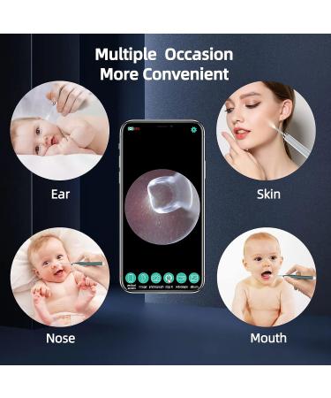Sanyare Earwax Removal Kit with 1080P HD Otoscope Camera and Light - 12 Pcs Spoon Set - Android and iOS Compatible - Solid Black - Buy Online on GoSupps.com