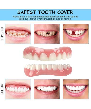Batlam Reusable Silicel Veneers - 15 Pairs of Upper & Underside Fake Teeth for Instant Smile Makeover | Cosmetic Tooth Whitening & Temporary Prosthesis - Buy Online on GoSupps.com