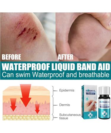 KOAHDE Gel Liquid Bandage 10ML - Breathable & Waterproof Wound Care for Minor Cuts - Buy Online on GoSupps.com