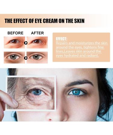  Generisch Snake Venom Peptide Firming Eye Cream with Snake Venom Anti-Wrinkle Eye Contour Cream Snake Venom Anti-Puffy Eye Contour Cream to Remove Dark Circles Bags and - Buy Online on GoSupps.com