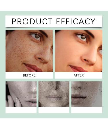  YOENBG Dark Spot Correction with Glowing Cream - Niacinamide Moisturizing and Brightening Face Serum Reducing Hyperpigmentation Fine Lines Blemishes and Even - Buy Online on GoSupps.com