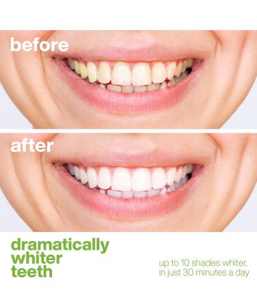 AquaSonic Professional Teeth Whitening Strips - Enamel Safe & Effective Spearmint - Easy to Use Non-Slip Affordable International Shipping - Buy Online on GoSupps.com