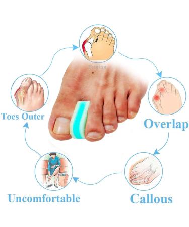Mcvcoyh 3-Layer Foam Toe Spacer & Bunion Corrector - 8 PC Set for Bunions Pain Relief (Soft & Lightweight) - Align & Separate Toes - Buy Online on GoSupps.com