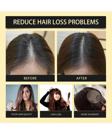 KLYso Shampoo For Cleansing Moisturizing And Smoothing The Scalp Improves Hair Quality Nourishes And Tames Frizzy Hair1PCS - Buy Online on GoSupps.com