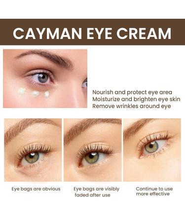 Collagen Retinol Under Eye Cream | Anti-Aging Solution for Dark Circles & Puffiness | Smooth Fine Lines - 0.7 oz - Buy Online on GoSupps.com