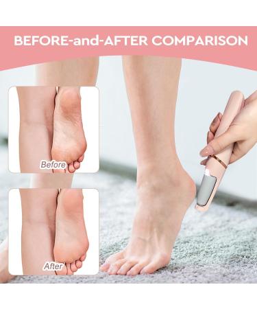 Nuve Smooth Pedicure Wand | Electric Callus Remover for Feet | Waterproof Portable Tool for Smooth Heels & Dead Skin Removal - Buy Online on GoSupps.com