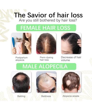 Rice Water for Hair Growth - Biotin & Castor Oil Serum Spray for Women | Hair Loss Treatment 1.7 Fl Oz - Buy Online on GoSupps.com