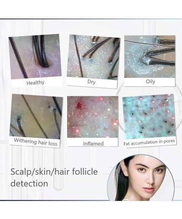 WDDEYYDS Scalp Detector & Hair Analyzer | 5x to 200x Zoom | LCD Display | Ideal for Hairdressing & Beauty Salons - Shop Now! - Buy Online on GoSupps.com