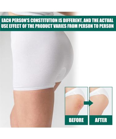  Uzionoie Butt Acne Cream Cream to Remove Acne on Buttocks Reduces Butt Pimples Restores Soft and Smooth Butt Skin 100ml - Buy Online on GoSupps.com