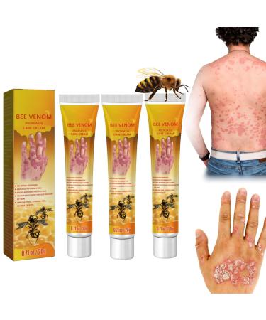 Bee Venom Psoriasis Treatment Cream New Zealand Bee Venom Professional Psoriasis Treatment Cream Soothing and Moisturizing Psoriasis Cream Psoriasis Treatment for Skin (Size : 3PCS)