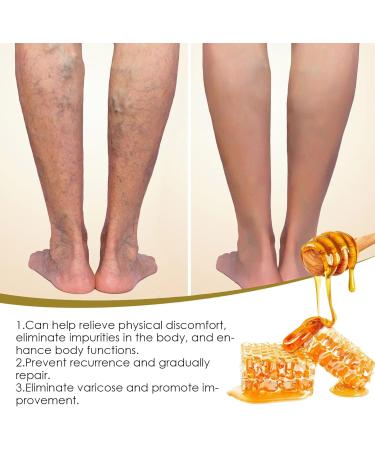 Lymphatic Drainage & Slimming Foot Soak Beads Lukmlca Bee Venom Foot Soak Foot Soak Salts Healthy Fast Shape & Cleanse Body Relief Relax Foot Soak For Hard Skin Foot Spa (1Bag-70ml) - Buy Online on GoSupps.com