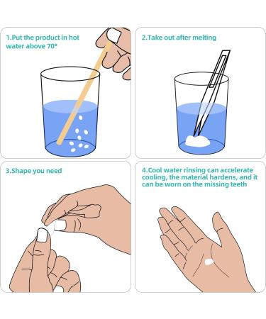Tooth Repair Kit - Temporary Teeth Filling Replacement for Chipped Teeth with Thermal Beads - Ideal for Fixing Missing or Broken Teeth - Buy Online on GoSupps.com