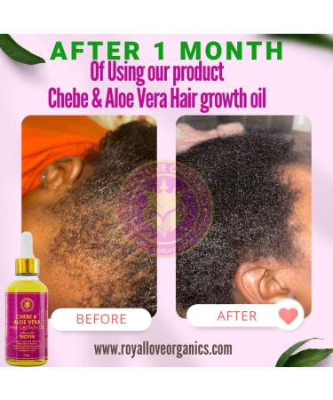 Chebe & Aloe Vera Fast Hair Growth Oil with Biotin - Natural Solution for Rapid Growth - Buy Online on GoSupps.com