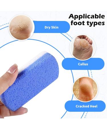 2 Pcs Glass Pumice Stone Set - Foot and Hand Callus Remover & Scrubber for Skin Exfoliation | Pedicure Exfoliator Tool for Home Pedicure - Buy Online on GoSupps.com